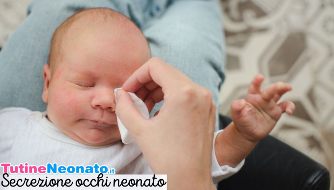 Eye secretion newborn